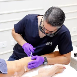 Escleroterapia